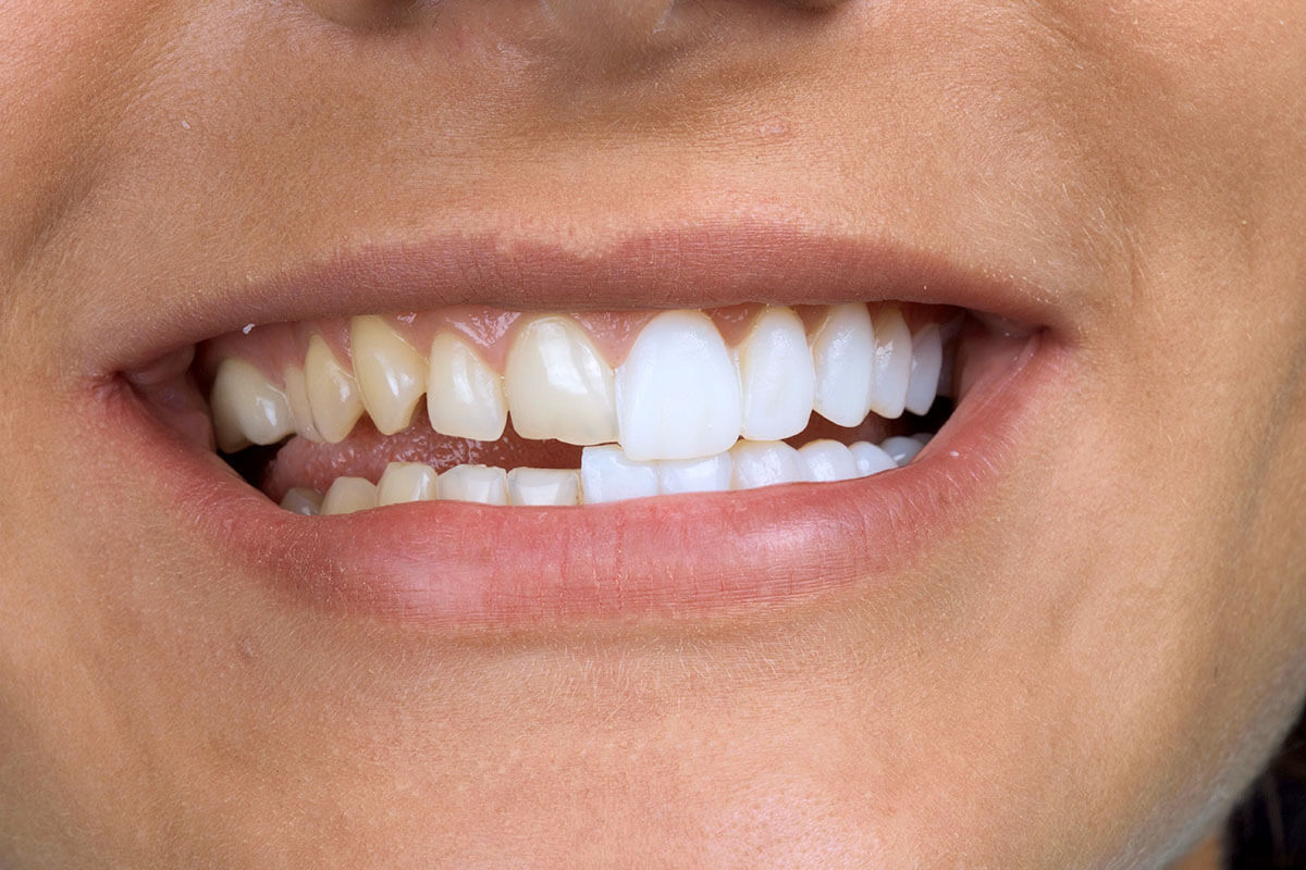 У кого больше всех зубов?