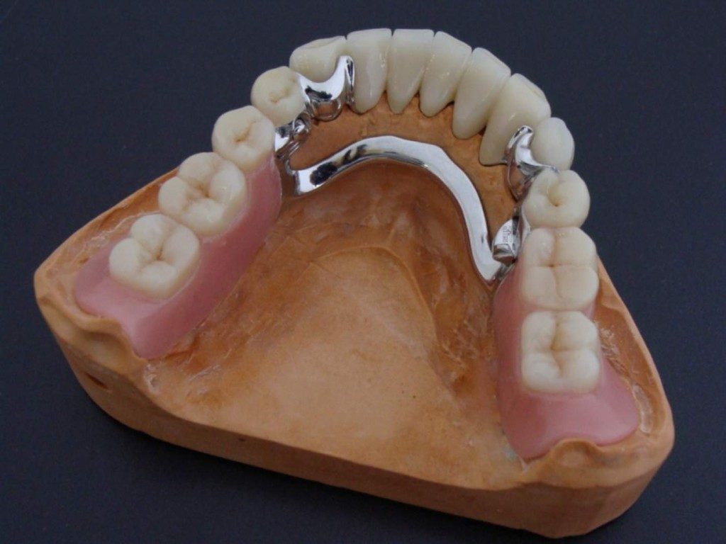 Зубные Протезы - Виды, Фото, Отзывы и Частые Вопросы | Efimed