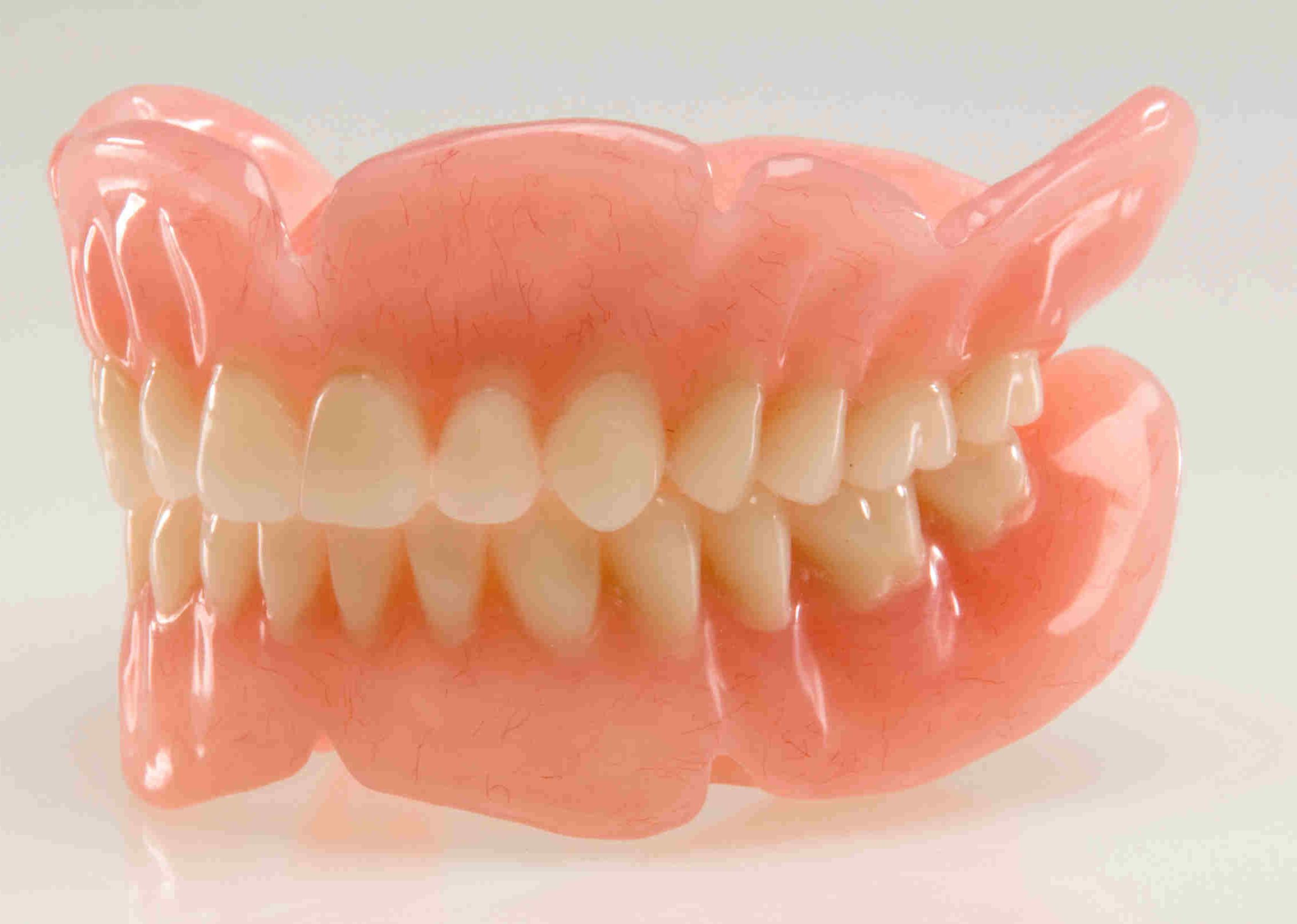 Как Выглядят Зубные Протезы Фото
